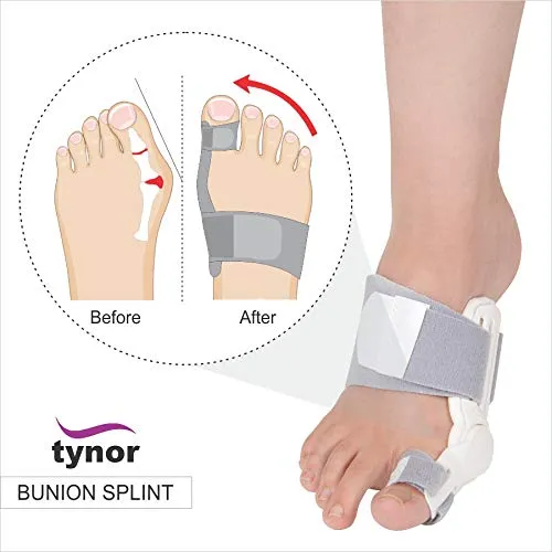 Bunion Splint